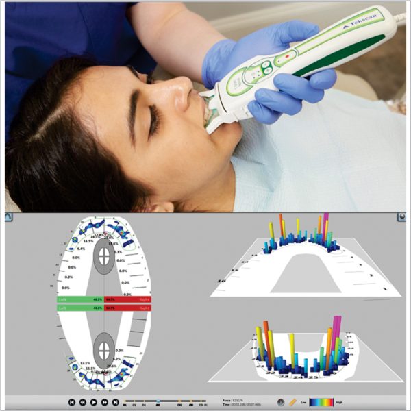 Máy phân tích khớp cắn điện toán T-Scan