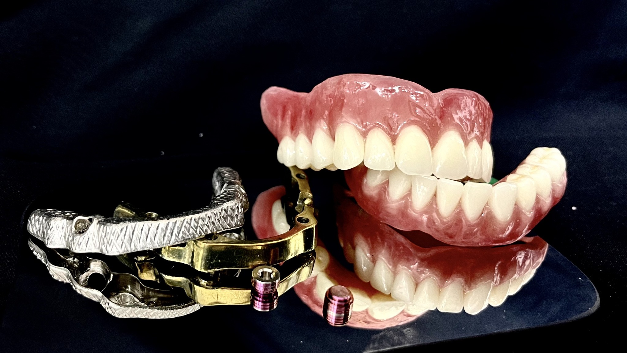 🎋 GIẢI PHÁP MỚI PHỤC HÌNH TRÊN IMPLANT BẰNG EZ LOCK ABUTMENT SYSTEM 🎋